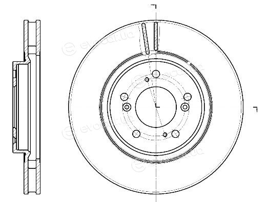 Remsa 61129.10